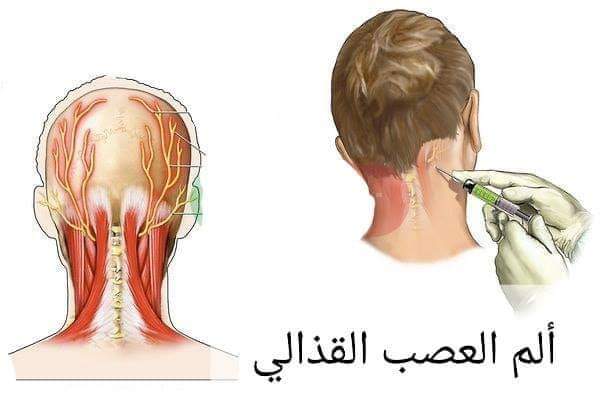 نقره لعرض الصورة في صفحة مستقلة
